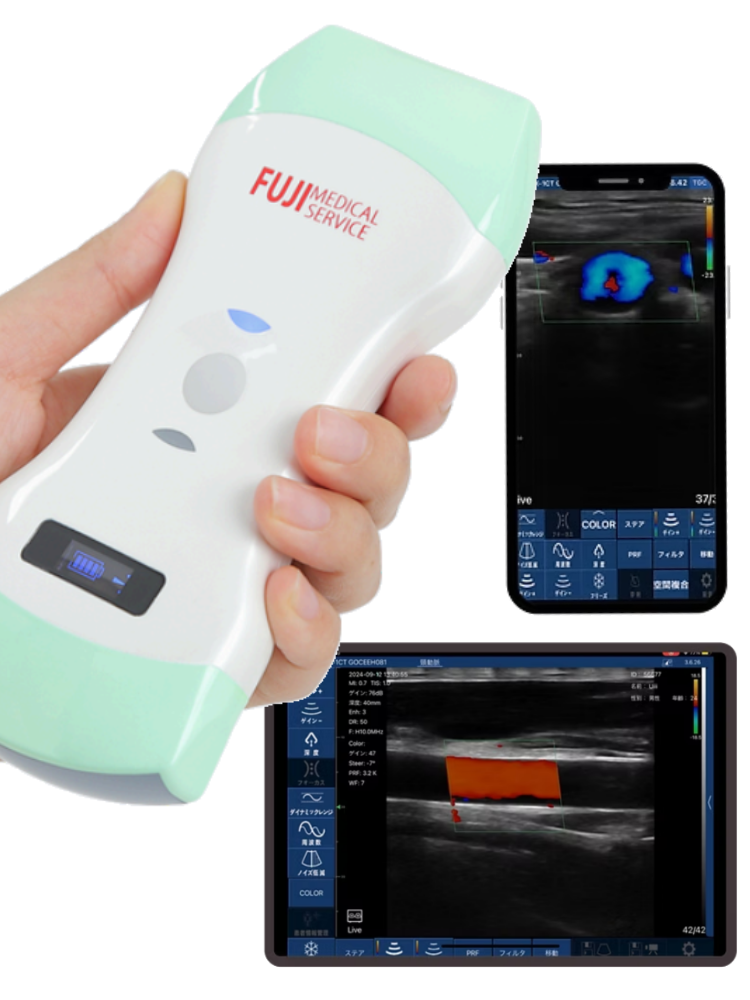 富士メディカルサービスのワイヤレス超音波診断装置「エコープロF2」